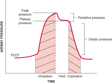 pressure curve