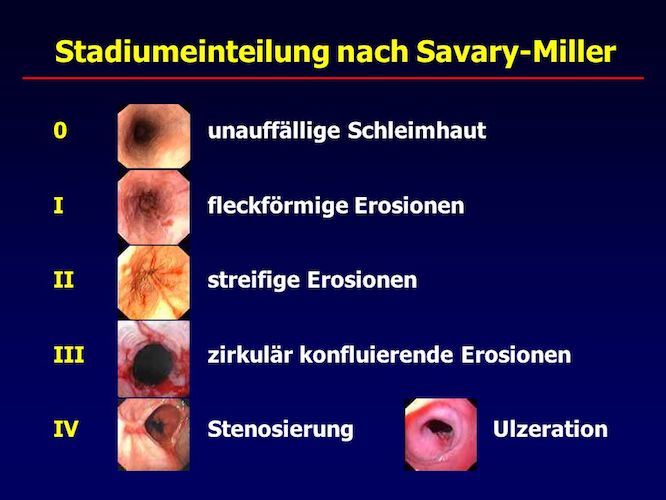 Savary-Miller